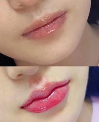 -Yestar 嘉兴艺星医疗美容医院