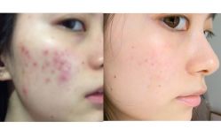 -SKINIST丽铂医疗美容