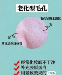 -凡碧诗毛孔清洁收细