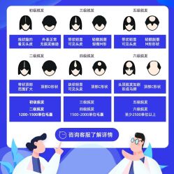 -大麦微针植发全国连锁