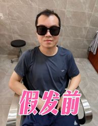 -唐风采假发补发定制