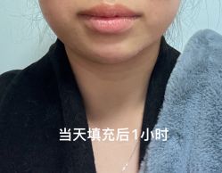 点击看大图 体验后-重庆军科整形美容医院