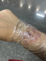 点击看大图 -天道专业洗纹身