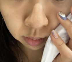 -广东韩妃整形外科医院