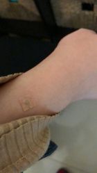 -肥三针腧穴瘦身馆
