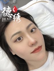 -德绣·机器野生眉发际线·美瞳线半永久