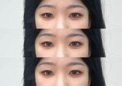 -Doris多里斯半永久纹眉·SMP纹发·发际线