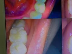 -土豆口腔(凤凰北总店)