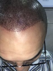 -雍禾植发全国连锁