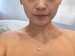 体验前-More摩尔医美の注射线雕光电中心