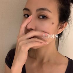 体验前-上海时光整形外科医院