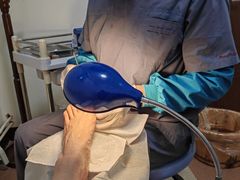 -世龙世家灰指甲鸡眼脚气甲沟炎跖疣护理(通州店)