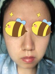 体验后-坤如玛丽·医疗美容中心