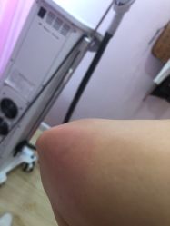 -晶奕空间专业脱毛连锁机构
