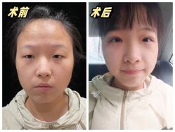 -素美医疗美容·西南眼鼻整形·修复基地