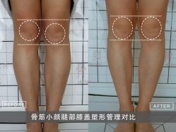 -至臻康妍健康管理中心