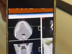 -土豆口腔(凤凰北总店)