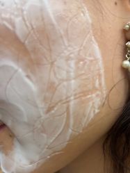 体验前-美瑞莎创美医疗美容