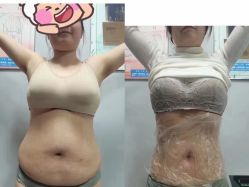 -瑞丝澜国际瘦身