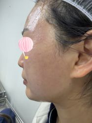 -长沙雅美医疗美容医院