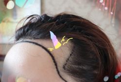 -大麦微针植发全国连锁