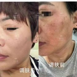 -智丽佳人祛斑祛痘美容美体