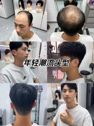 -唐风采假发补发定制