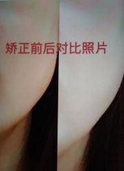 -颜和骨正·明哲式骨相美学整骨