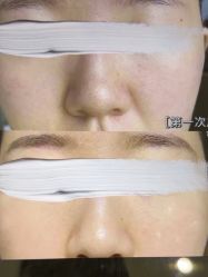 -SKIN79皮肤管理中心