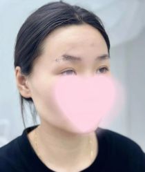 点击看大图 -张小野·专业半永久纹眉