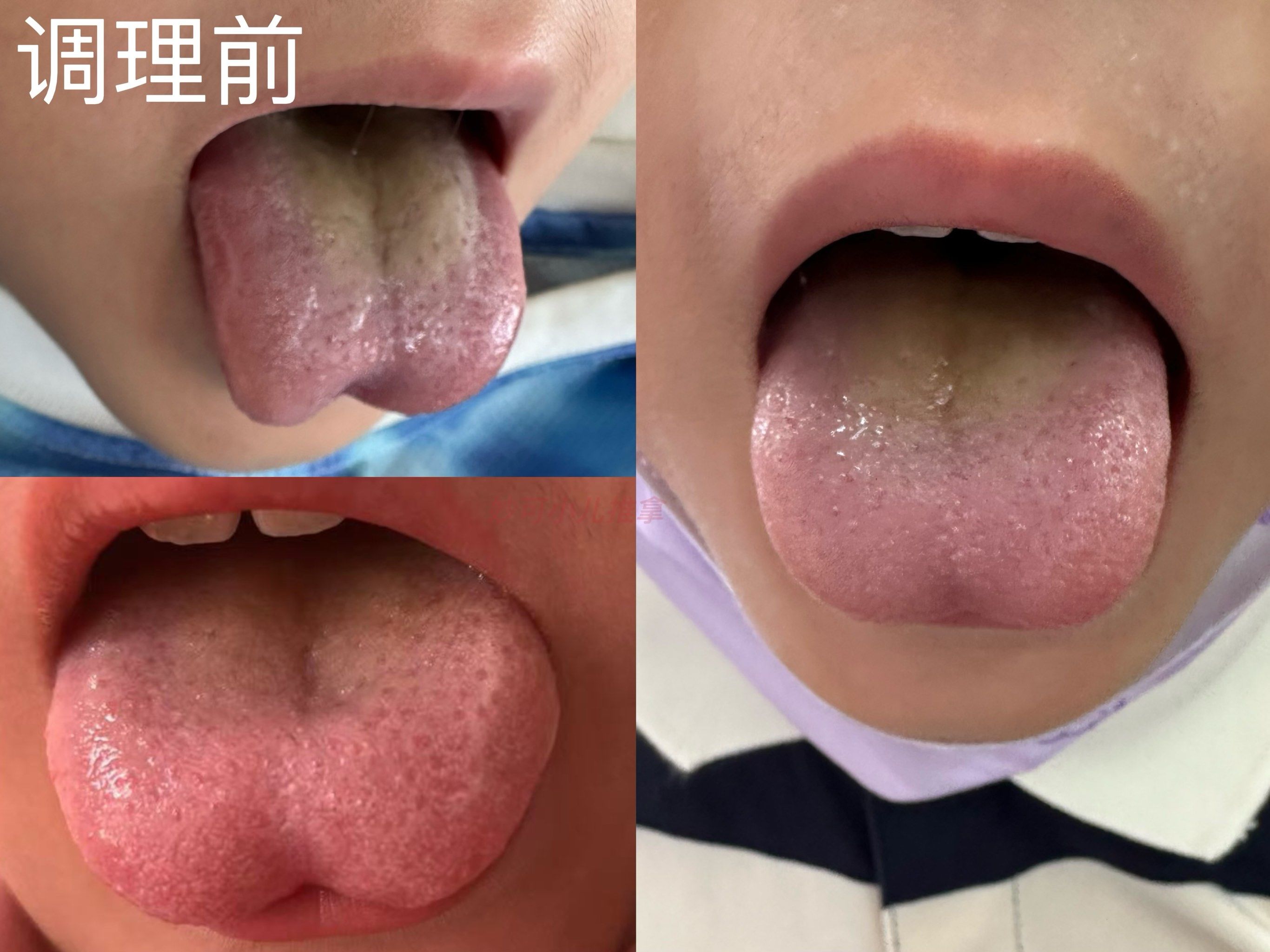 从第一副图的舌头,到现在调理第三天一个周
