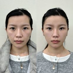 点击看大图 -Yestar艺星医疗美容医院