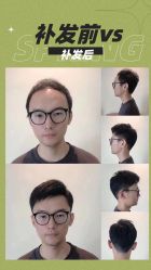 点击看大图 -极客侠男士假发定制补发