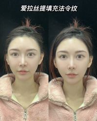 点击看大图 体验前-欧扬医疗美容