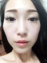 iphone_upload_pic-芷妍医美