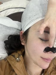 -悟空祛痘·诺奖技术专业店