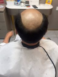 -唐风采假发补发定制