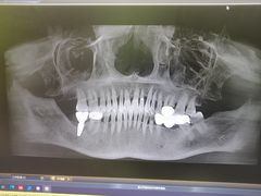 -极光口腔·矫正种植修复(锦江店)