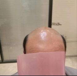 -唐风采假发补发定制