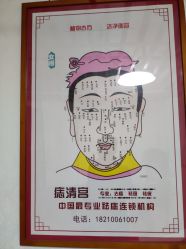 -痣清宫祛斑祛痣连锁店
