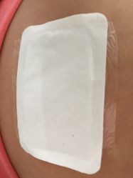 -肥三针腧穴瘦身馆