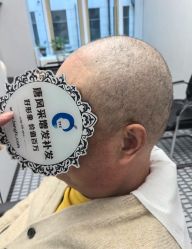 -唐风采假发补发定制