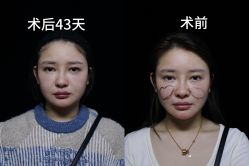 -上海时光整形外科医院