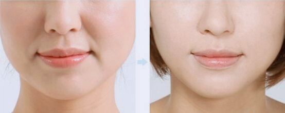 点击看大图 -SKINIST丽铂医疗美容