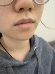-长沙雅美医疗美容医院