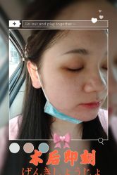 -东莞西妃整形美容医院