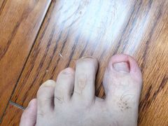 -郑远元专业修脚房·按摩·肉刺·灰指甲(新亭路店)