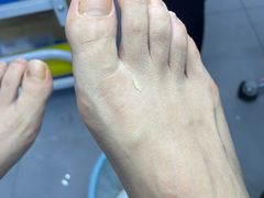 -世龙世家甲沟炎·灰指甲·嵌甲矫正·修脚(武侯区双楠店)