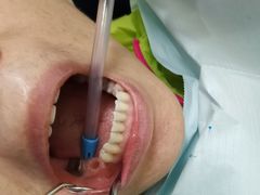 -爱贝口腔·牙周诊疗·种植修复中心