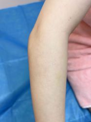 体验后-深圳美莱医疗美容医院